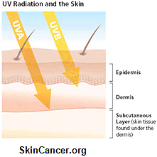 UVradiation